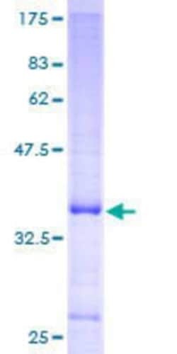 Novus Biologicals Recombinant Human ZBTB7A/Pokemon GST (N-Term) Protein 25 &mu;g | Buy Online | Novus Biologicals&trade; | Fisher Scientific