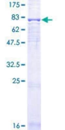 Novus Biologicals Recombinant Human FZR1/CDH1 GST (N-Term) Protein 25 &mu;g | Buy Online | Novus Biologicals&trade; | Fisher Scientific
