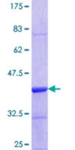 Novus Biologicals Recombinant Human FZR1/CDH1 GST (N-Term) Protein 25 &mu;g | Buy Online | Novus Biologicals&trade; | Fisher Scientific