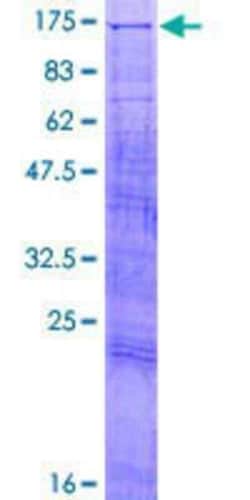 Novus Biologicals Recombinant Human JIK GST (N-Term) Protein 2 &mu;g | Buy Online | Novus Biologicals&trade; | Fisher Scientific