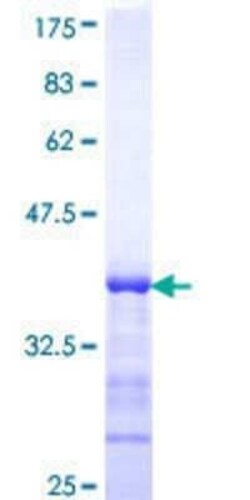 Novus Biologicals Recombinant Human JIK GST (N-Term) Protein 10 &mu;g | Buy Online | Novus Biologicals&trade; | Fisher Scientific