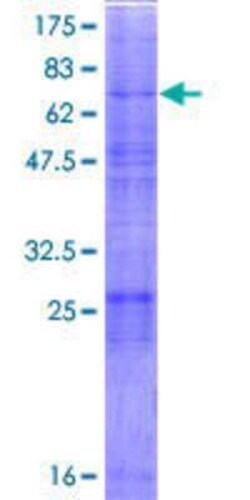 Novus Biologicals Recombinant Human MBTPS2 GST (N-Term) Protein 2 &mu;g | Buy Online | Novus Biologicals&trade; | Fisher Scientific