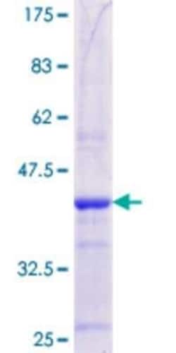 Novus Biologicals Recombinant Human MBTPS2 GST (N-Term) Protein 10 &mu;g | Buy Online | Novus Biologicals&trade; | Fisher Scientific