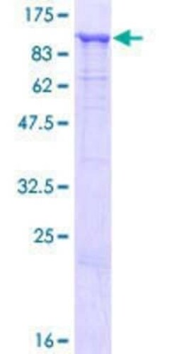 Novus Biologicals Recombinant Human HOOK1 GST (N-Term) Protein 25 &mu;g | Buy Online | Novus Biologicals&trade; | Fisher Scientific