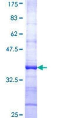 Novus Biologicals Recombinant Human HOOK1 GST (N-Term) Protein 25 &mu;g | Buy Online | Novus Biologicals&trade; | Fisher Scientific