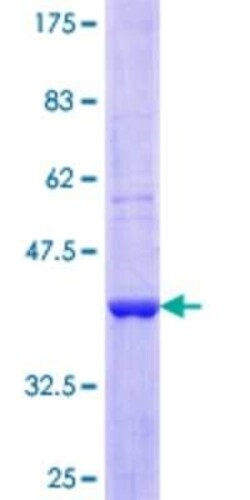 Novus Biologicals Recombinant Human CDC40 GST (N-Term) Protein 10 &mu;g | Buy Online | Novus Biologicals&trade; | Fisher Scientific