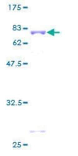 Novus Biologicals Recombinant Human BLU GST (N-Term) Protein 2 &mu;g | Buy Online | Novus Biologicals&trade; | Fisher Scientific