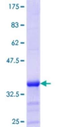Novus Biologicals Recombinant Human BLU GST (N-Term) Protein 25 &mu;g | Buy Online | Novus Biologicals&trade; | Fisher Scientific