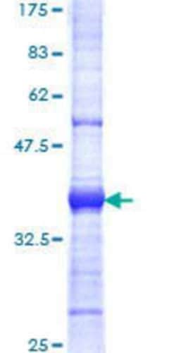 Novus Biologicals Recombinant Human UBR5/EDD GST (N-Term) Protein 10 &mu;g | Buy Online | Novus Biologicals&trade; | Fisher Scientific