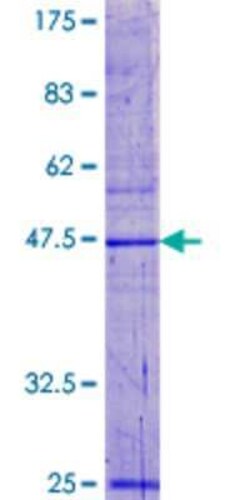 Novus Biologicals Recombinant Human RPP20 GST (N-Term) Protein 25 &mu;g | Buy Online | Novus Biologicals&trade; | Fisher Scientific