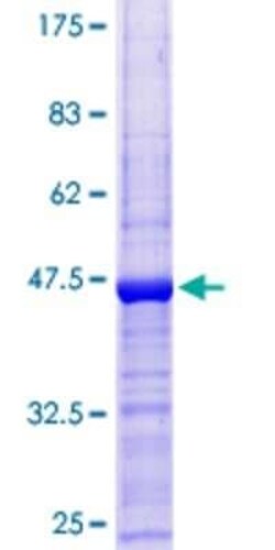 Novus Biologicals Recombinant Human HSPC014 GST (N-Term) Protein 10 &mu;g | Buy Online | Novus Biologicals&trade; | Fisher Scientific