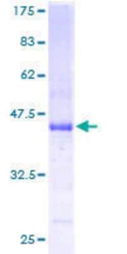 R&D Systems&trade;&nbsp;Recombinant Human APR3 GST (N-Term) Protein