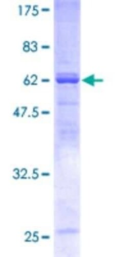 Novus Biologicals Recombinant Human SNX7 GST (N-Term) Protein 25 &mu;g | Buy Online | Novus Biologicals&trade; | Fisher Scientific