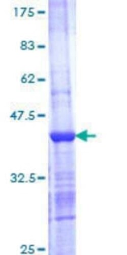 Novus Biologicals Recombinant Human SNX7 GST (N-Term) Protein 25 &mu;g | Buy Online | Novus Biologicals&trade; | Fisher Scientific