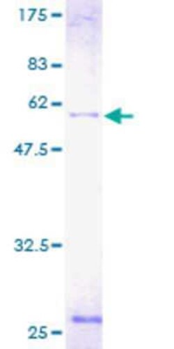 Novus Biologicals Recombinant Human ATP6V1D GST (N-Term) Protein 2 &mu;g | Buy Online | Novus Biologicals&trade; | Fisher Scientific