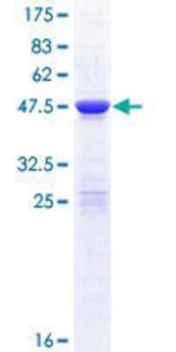 Novus Biologicals Recombinant Human COMMD10 GST (N-Term) Protein 25 &mu;g | Buy Online | Novus Biologicals&trade; | Fisher Scientific