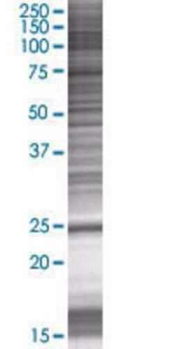 Novus Biologicals COMMD10 293T Cell Transient Overexpression Lysate 0.1 mL | Buy Online | Novus Biologicals&trade; | Fisher Scientific