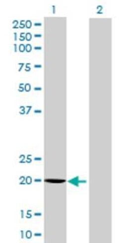 Novus Biologicals COMMD10 293T Cell Transient Overexpression Lysate 0.1 mL | Buy Online | Novus Biologicals&trade; | Fisher Scientific