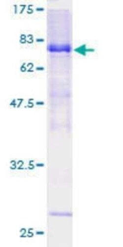 Novus Biologicals Recombinant Human HSFX1/2 GST (N-Term) Protein 10 &mu;g | Buy Online | Novus Biologicals&trade; | Fisher Scientific