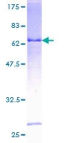 Novus Biologicals Recombinant Human HEMK1 GST (N-Term) Protein 25 &mu;g | Buy Online | Novus Biologicals&trade; | Fisher Scientific
