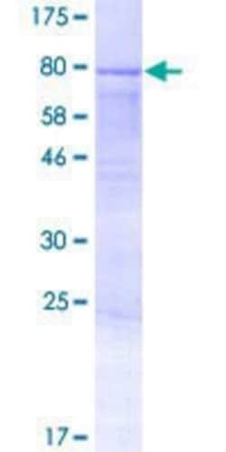 Novus Biologicals Recombinant Human AMOTL2 GST (N-Term) Protein 10 &mu;g | Buy Online | Novus Biologicals&trade; | Fisher Scientific