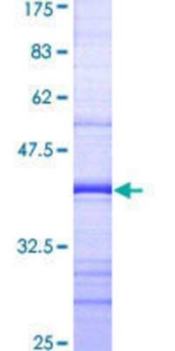 Novus Biologicals Recombinant Human PRKAG2 GST (N-Term) Protein 10 &mu;g | Buy Online | Novus Biologicals&trade; | Fisher Scientific