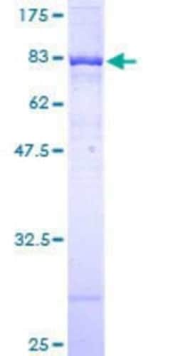 Novus Biologicals Recombinant Human DNA Polymerase Kappa GST (N-Term) Protein 10 &mu;g | Buy Online | Novus Biologicals&trade; | Fisher Scientific