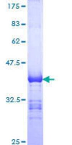 Novus Biologicals Recombinant Human DDX41 GST (N-Term) Protein 25 &mu;g | Buy Online | Novus Biologicals&trade; | Fisher Scientific