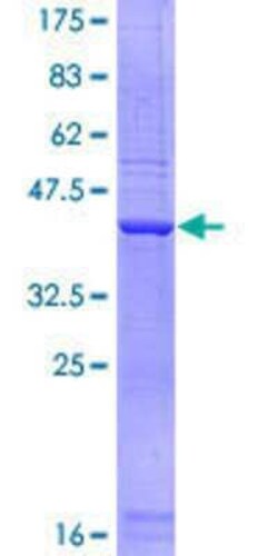 Novus Biologicals Recombinant Human SCARA3 GST (N-Term) Protein 25 &mu;g | Buy Online | Novus Biologicals&trade; | Fisher Scientific