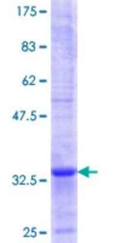 Novus Biologicals Recombinant Human Melanoma antigen family C2 GST (N-Term) Protein 10 &mu;g | Buy Online | Novus Biologicals&trade; | Fisher Scientific