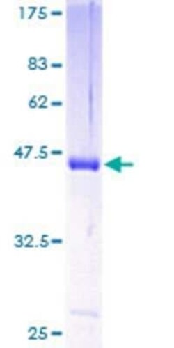 Novus Biologicals Recombinant Human Hippocalcin like 4 GST (N-Term) Protein 25 &mu;g | Buy Online | Novus Biologicals&trade; | Fisher Scientific