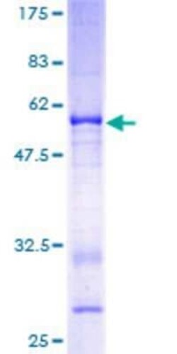 Novus Biologicals Recombinant Human VGLL1 GST (N-Term) Protein 25 &mu;g | Buy Online | Novus Biologicals&trade; | Fisher Scientific