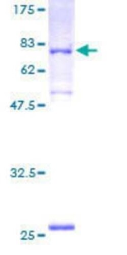 Novus Biologicals Recombinant Human PCYOX1 GST (N-Term) Protein 25 &mu;g | Buy Online | Novus Biologicals&trade; | Fisher Scientific