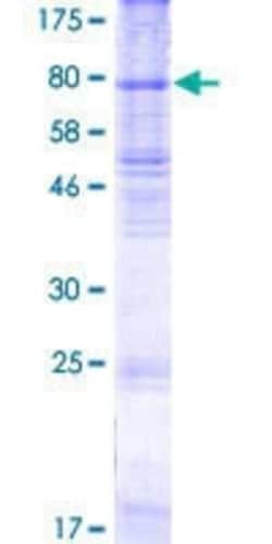 Novus Biologicals Recombinant Human RHCG GST (N-Term) Protein 2 &mu;g | Buy Online | Novus Biologicals&trade; | Fisher Scientific