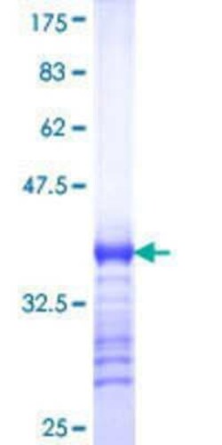 Novus Biologicals Recombinant Human RHCG GST (N-Term) Protein 10 &mu;g | Buy Online | Novus Biologicals&trade; | Fisher Scientific