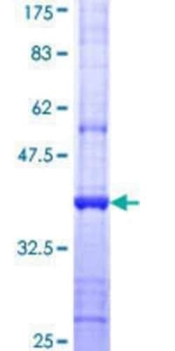 Novus Biologicals Recombinant Human SFMBT1 GST (N-Term) Protein 10 &mu;g | Buy Online | Novus Biologicals&trade; | Fisher Scientific