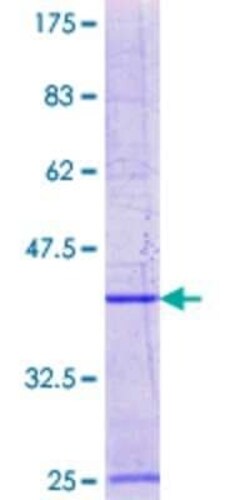 Novus Biologicals Recombinant Human CmL2 GST (N-Term) Protein 25 &mu;g | Buy Online | Novus Biologicals&trade; | Fisher Scientific