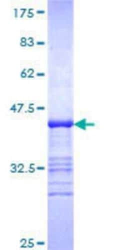 Novus Biologicals Recombinant Human ISYNA1 GST (N-Term) Protein 25 &mu;g | Buy Online | Novus Biologicals&trade; | Fisher Scientific