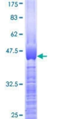 Novus Biologicals Recombinant Human VCX3A GST (N-Term) Protein 10 &mu;g | Buy Online | Novus Biologicals&trade; | Fisher Scientific