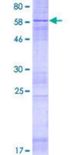 Novus Biologicals Recombinant Human PTPLAD1 GST (N-Term) Protein 2 &mu;g | Buy Online | Novus Biologicals&trade; | Fisher Scientific