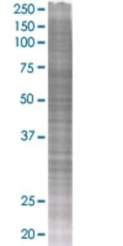 Novus Biologicals&trade;&nbsp;PTPLAD1 293T Cell Transient Overexpression Lysate