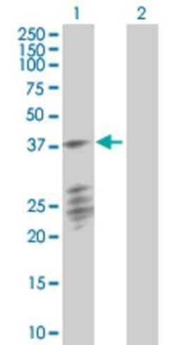 Novus Biologicals PTPLAD1 293T Cell Transient Overexpression Lysate 0.1 mL | Buy Online | Novus Biologicals&trade; | Fisher Scientific