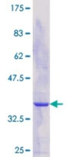 Novus Biologicals Recombinant Human TH1L GST (N-Term) Protein 25 &mu;g | Buy Online | Novus Biologicals&trade; | Fisher Scientific