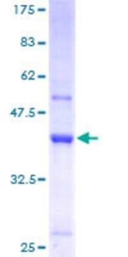 Novus Biologicals Recombinant Human HPSC152 GST (N-Term) Protein 25 &mu;g | Buy Online | Novus Biologicals&trade; | Fisher Scientific