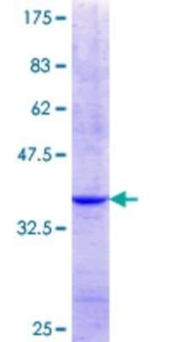 Novus Biologicals Recombinant Human NCKIPSD GST (N-Term) Protein 10 &mu;g | Buy Online | Novus Biologicals&trade; | Fisher Scientific