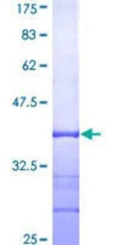 Novus Biologicals Recombinant Human CXXC5 GST (N-Term) Protein 10 &mu;g | Buy Online | Novus Biologicals&trade; | Fisher Scientific