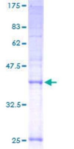 Novus Biologicals Recombinant Human TMEM 138 GST (N-Term) Protein 25 &mu;g | Buy Online | Novus Biologicals&trade; | Fisher Scientific