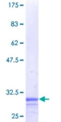 Novus Biologicals Recombinant Human NIPA GST (N-Term) Protein 25 &mu;g | Buy Online | Novus Biologicals&trade; | Fisher Scientific