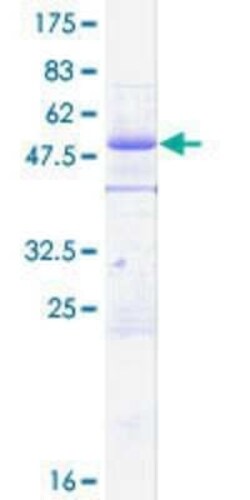 Novus Biologicals Recombinant Human NIPA GST (N-Term) Protein 10 &mu;g | Buy Online | Novus Biologicals&trade; | Fisher Scientific