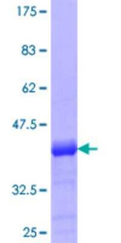 Novus Biologicals Recombinant Human PHF7 GST (N-Term) Protein 10 &mu;g | Buy Online | Novus Biologicals&trade; | Fisher Scientific
